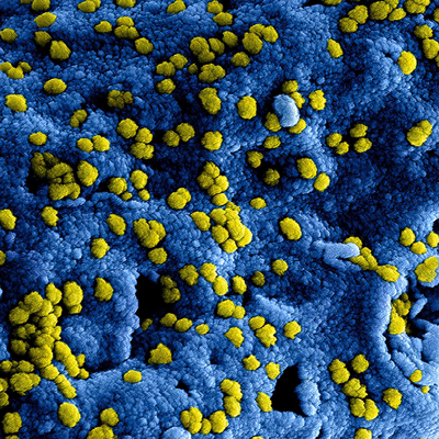 Microscopic image of STI bacteria